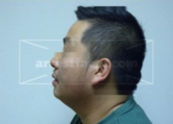 Robert Nmi Thao
