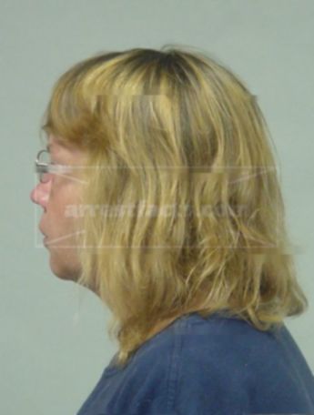 Brenda L Gilbert