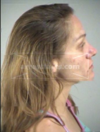 Jodi Lyn Insco