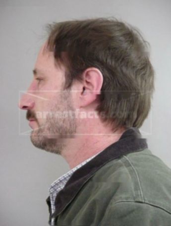 Glen J Landowski
