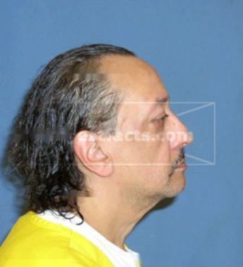 Thomas Carter