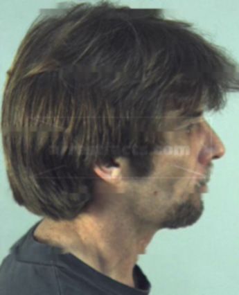 Richard Daniel Atchison