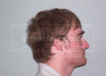 Timothy J Murtaugh