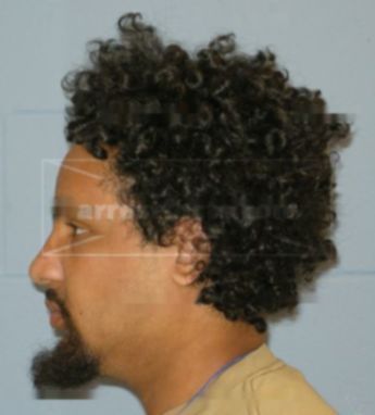 Christopher Perez