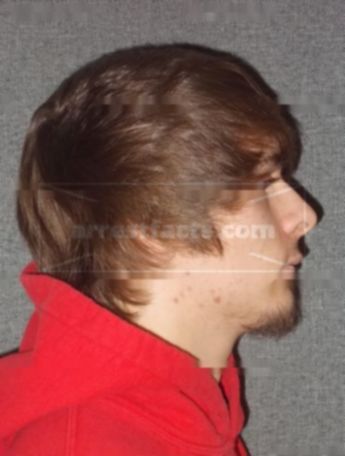 Jacob T Kozina