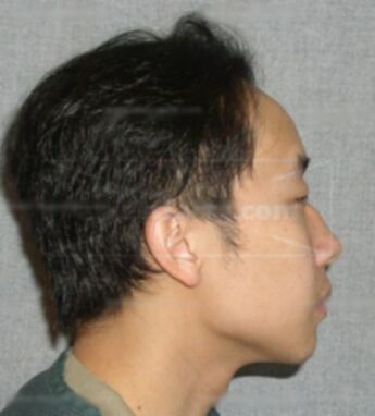 Herpao Vang