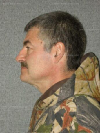 Patrick J Nievinski