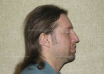 Matthew J Mach