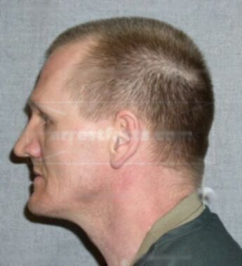 Roger D Huberd