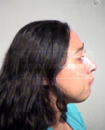 Angela Orduno