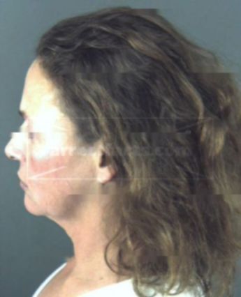 Rene Dawn Newell