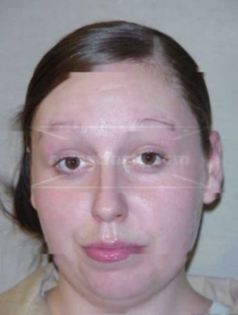 Jasmine Ackerman