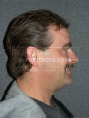 Chad E Leggett
