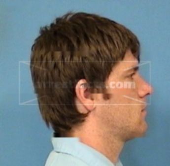 Matthew O. Schwass
