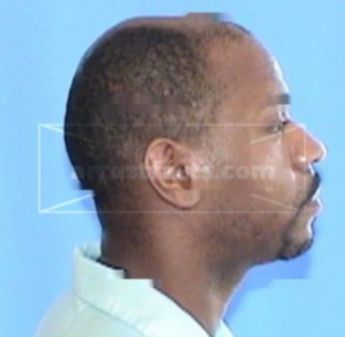 Byron Denton
