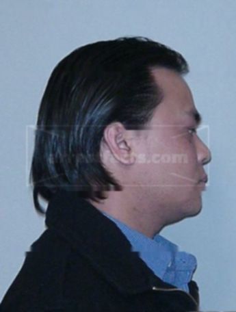 Pel Khuy