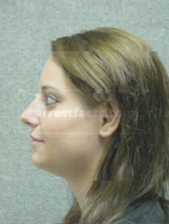 Angela D Burkholder