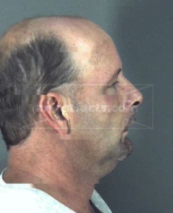 Roscoe Briggs Higginbotham Jr.
