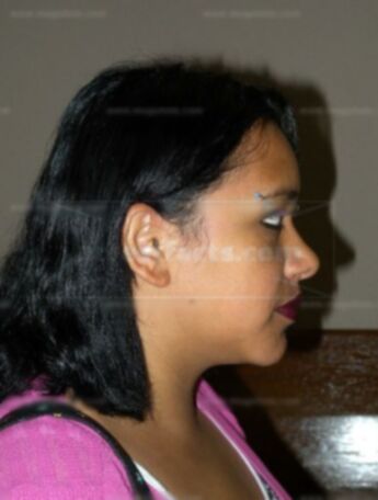 Dixsia Dedrickson