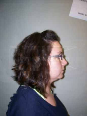 Aubrey L Werner