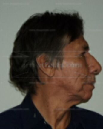 Donald R Littlehawk