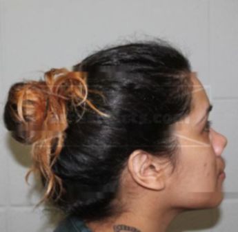 Crystal F Quinones