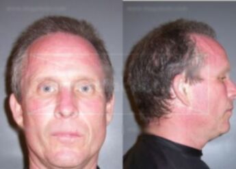 Gregg Arthur Anderson