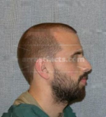 Jacob J Gaffney