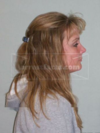 Theresa L Schmidt