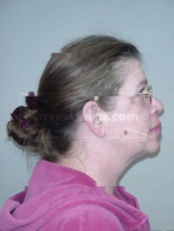 Lori D Koppenhaver