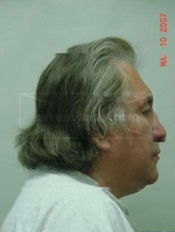 Gilbert J Blaker Jr.