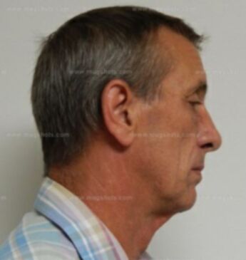 Danny Jackson