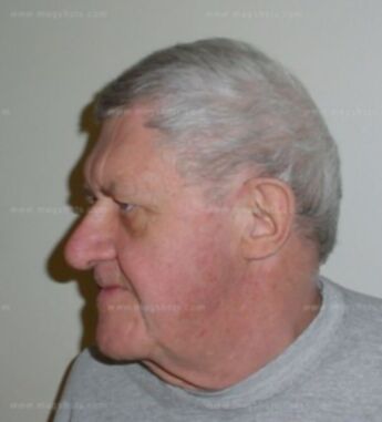 Gene Retzlaff
