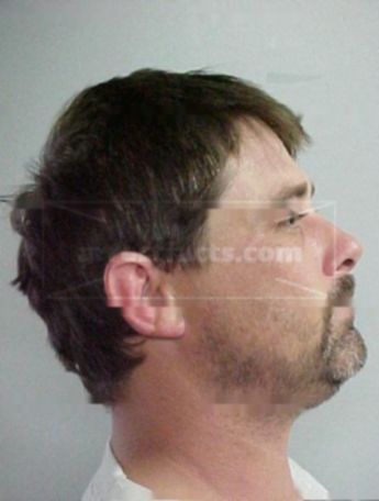 Rex Deshazo