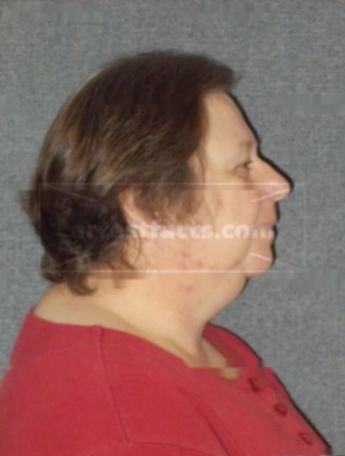 Vicki A Kent