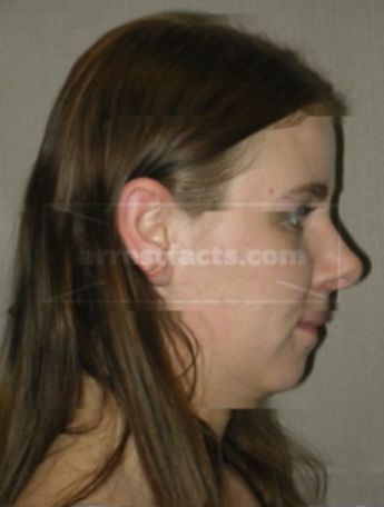 Melissa M Mccallister