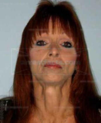 Denise Harrison