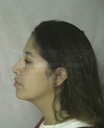 Patricia L Carrion