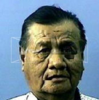 Albert Goldtooth