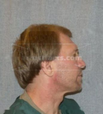 Randy A Lapp