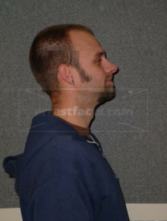 Chad J Frazer