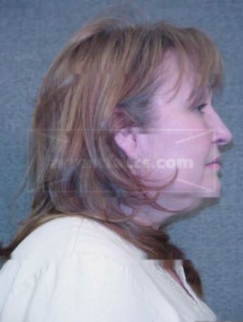 Barbara J Bennett