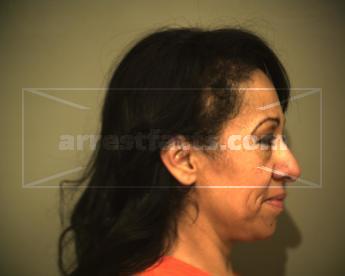 Susana Carrizales Garza