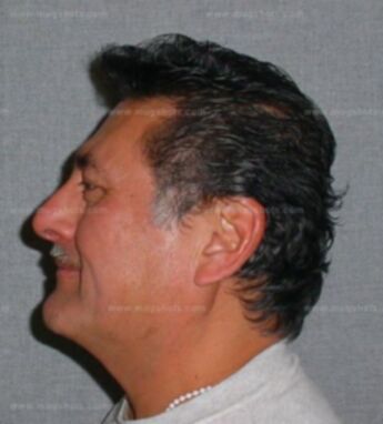 Raul V Garza