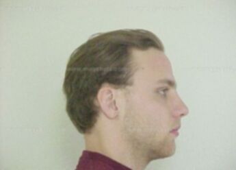 Christopher D Patton
