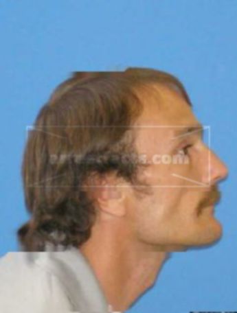 Alfred C Pridemore