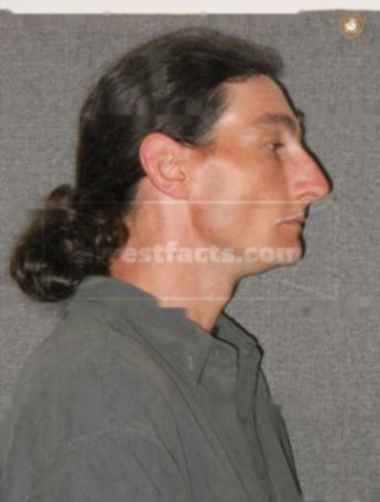 Mitchel J Disch