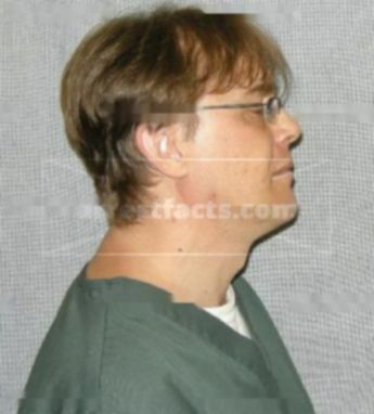 Jeffrey J Burnett