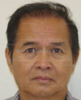 Ernesto Romero Lacson