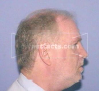 Randall D. Brown